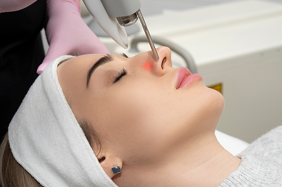 a lady having a vascular treatment performed on her nose by a technician using a laser wearing pink gloves